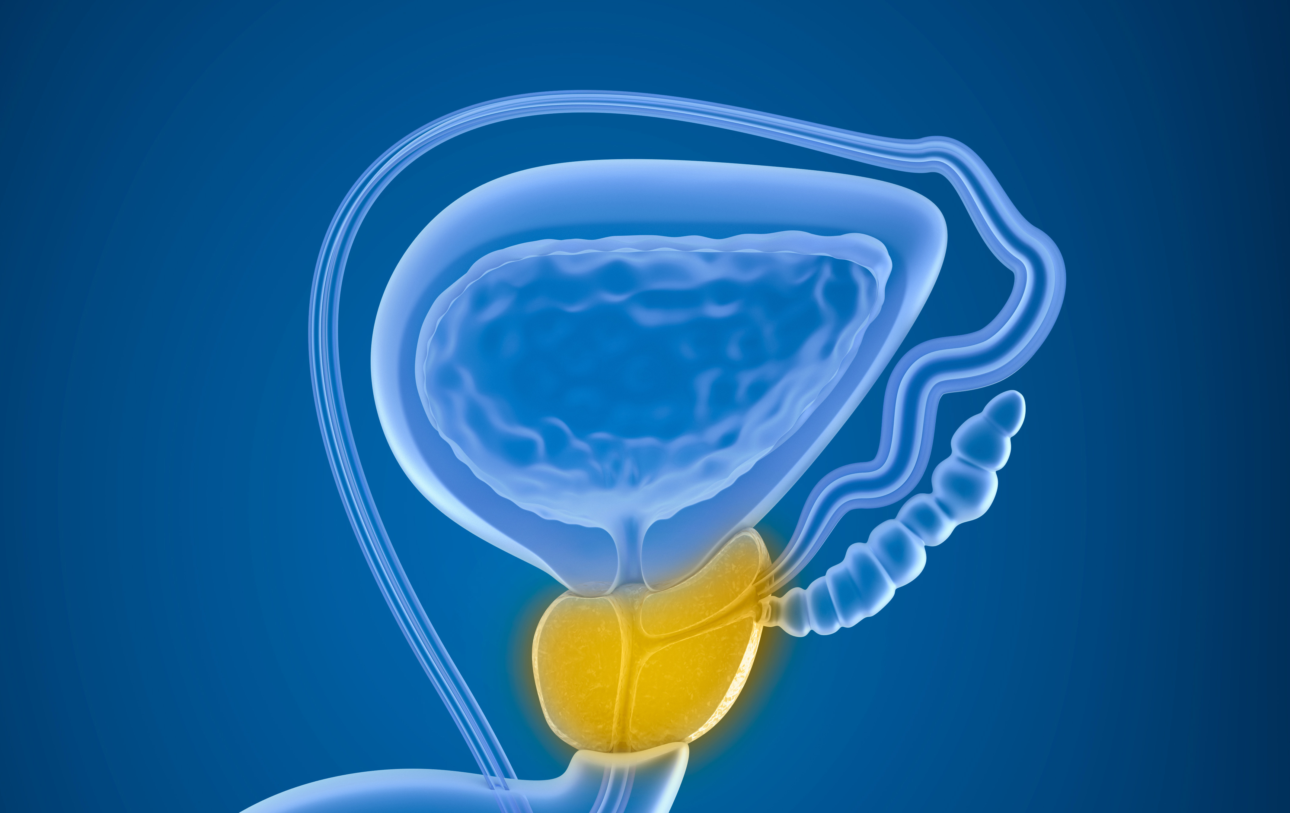 bakterijska upala prostate, prostatitis | zdravlje i prevencija, muško zdravlje,magazin
